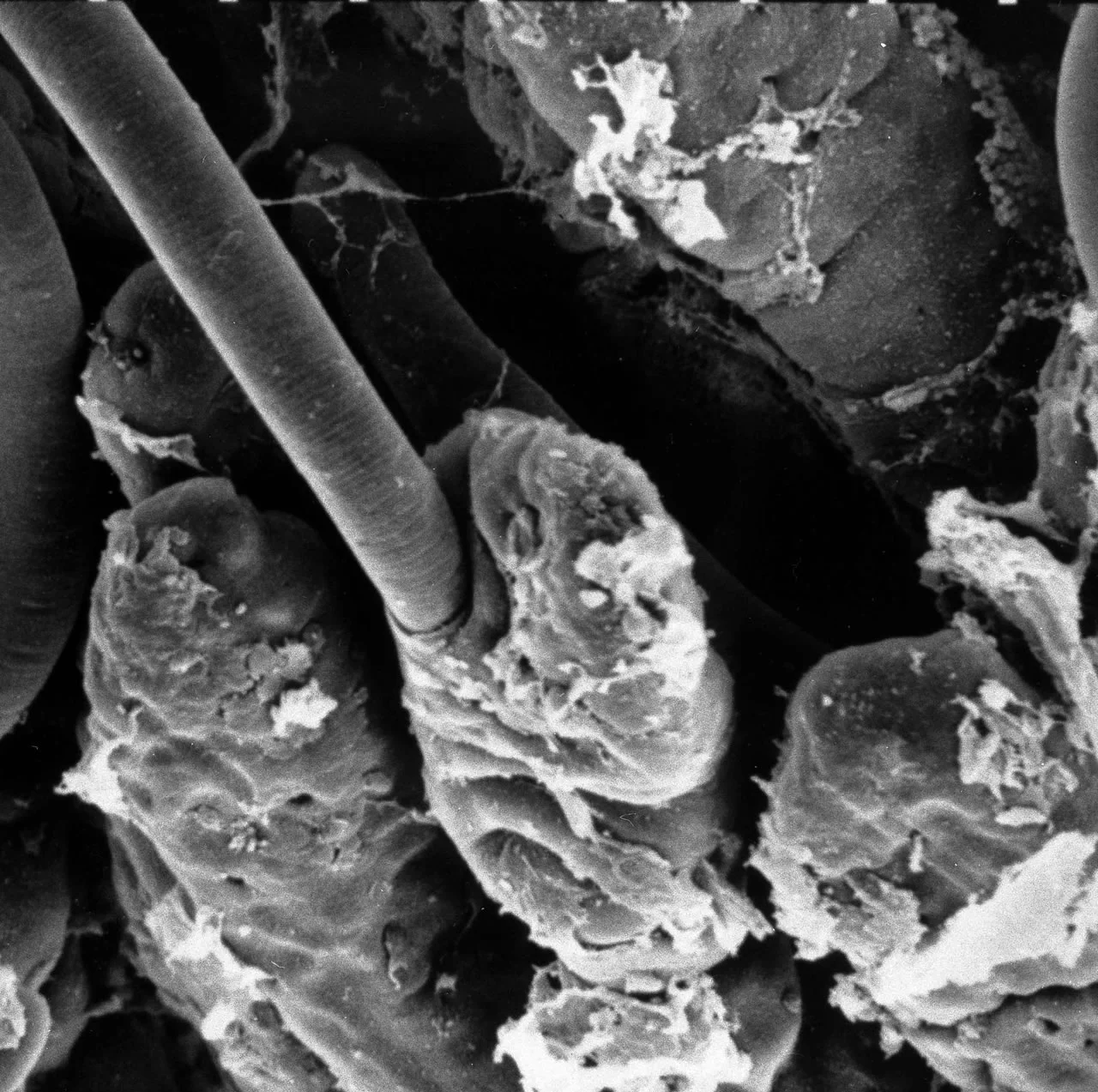 L1 entering columnar epithelium SEM. Courtesy K. Wright