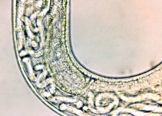 Adult female, high magnification. Note newborn larvae.