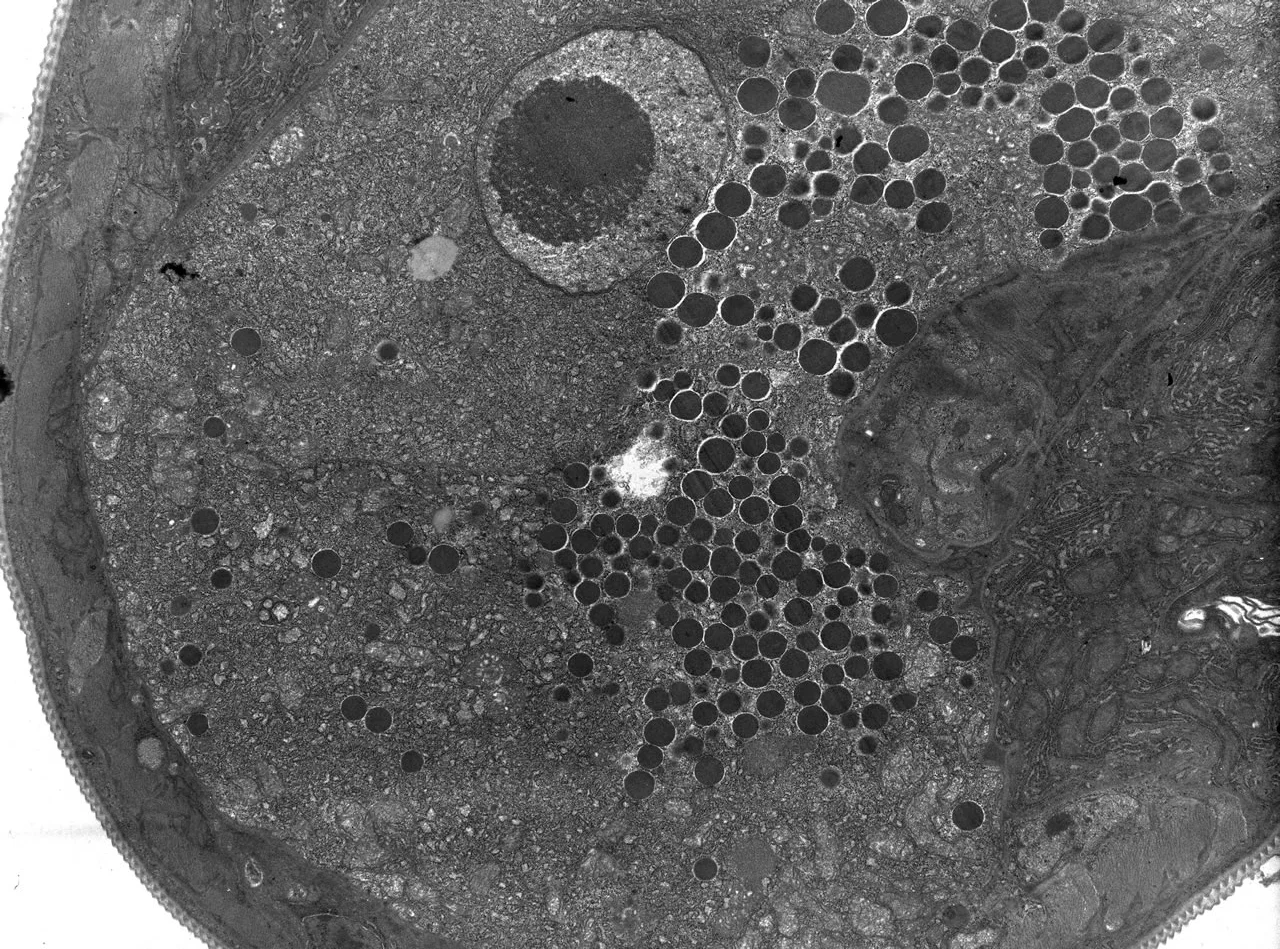 Adult Female stichocyte TEM