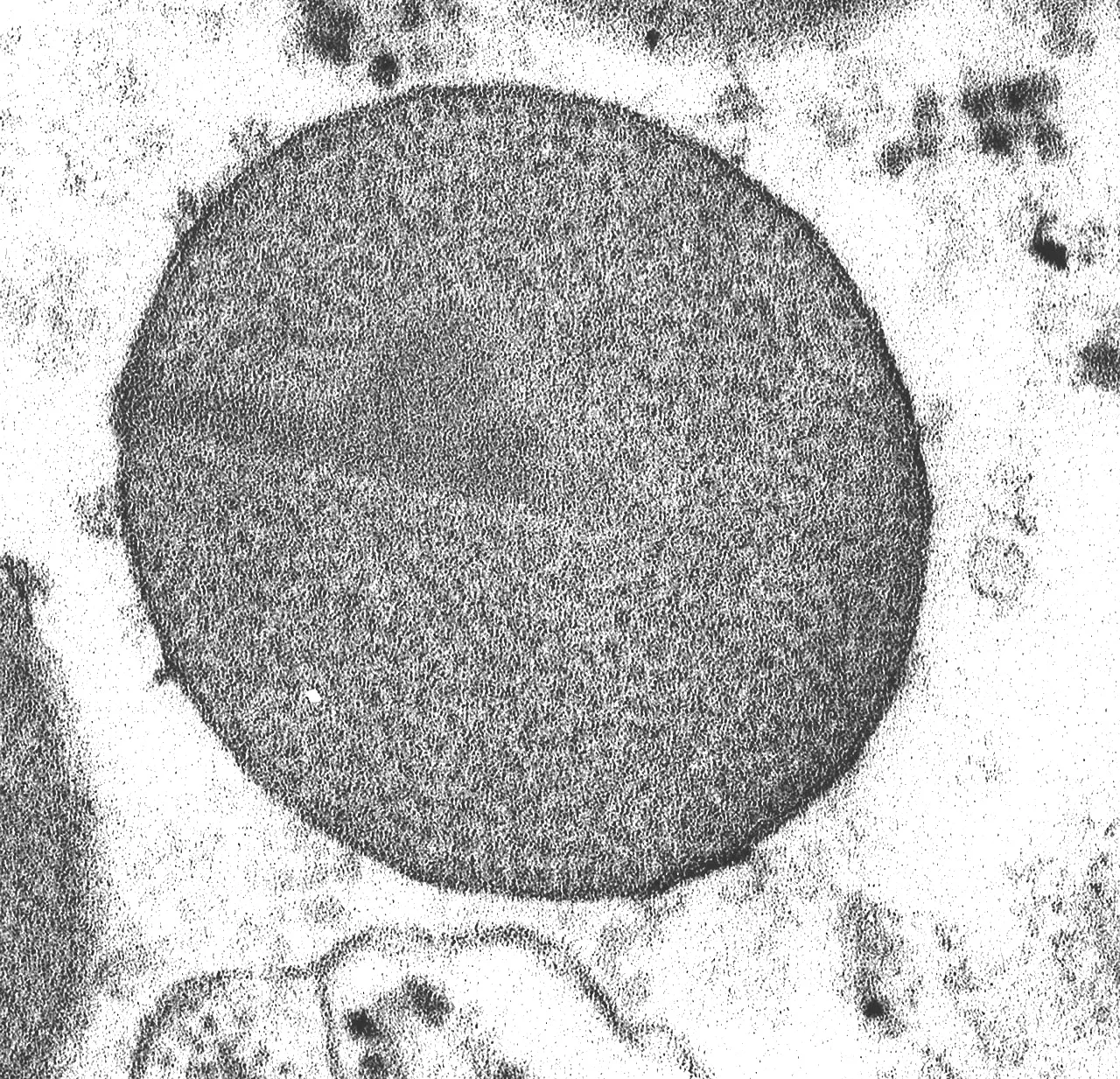 L1 alpha 2 granule. TEM