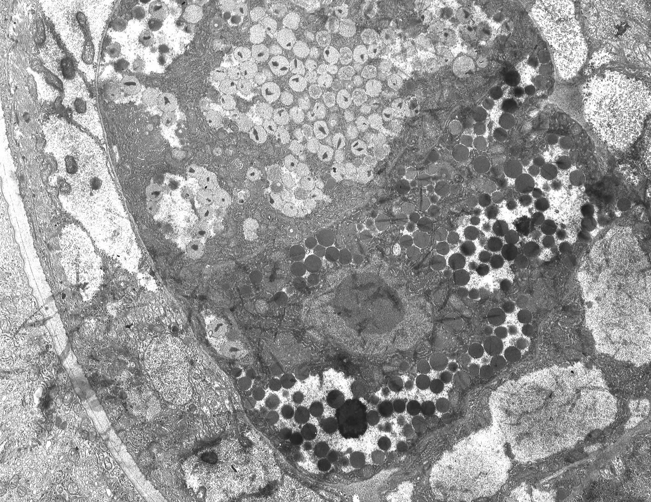 L1 alpha and beta stichocytes. Longitudinal section. TEM