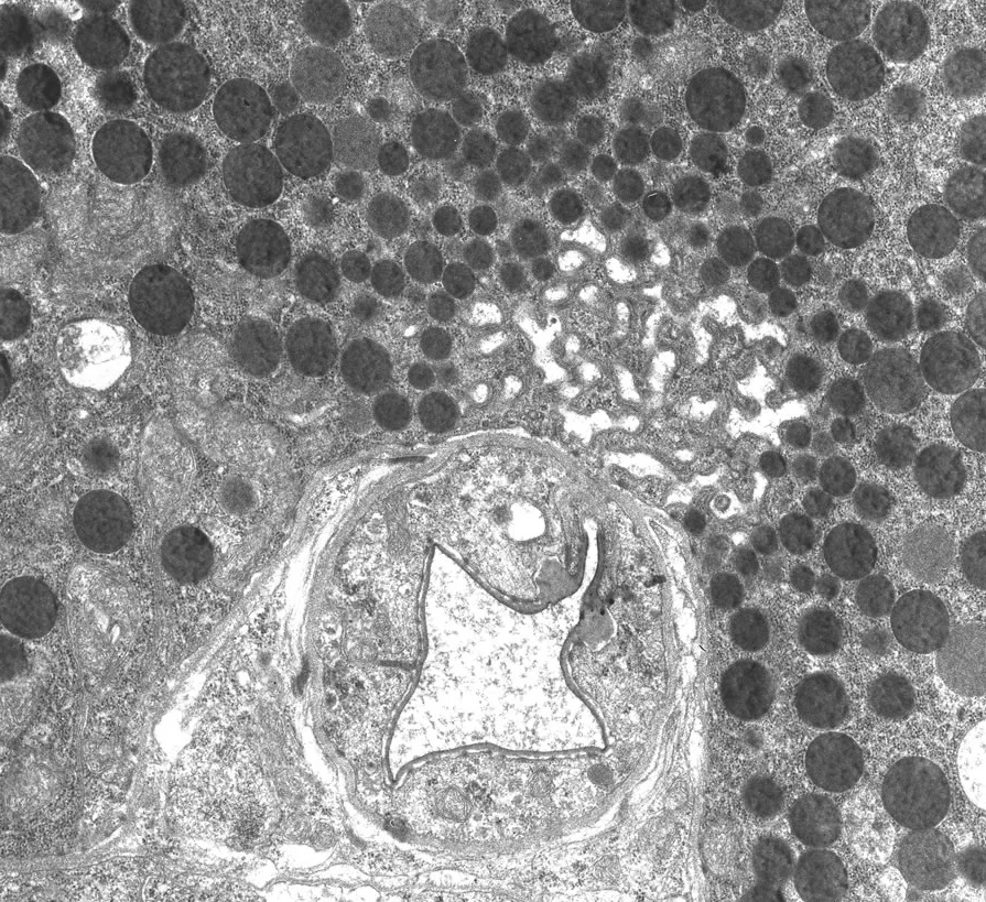 L1 8 hr post oral infection, beta 1 stichocyte, higher magnfication. Note duct. TEM