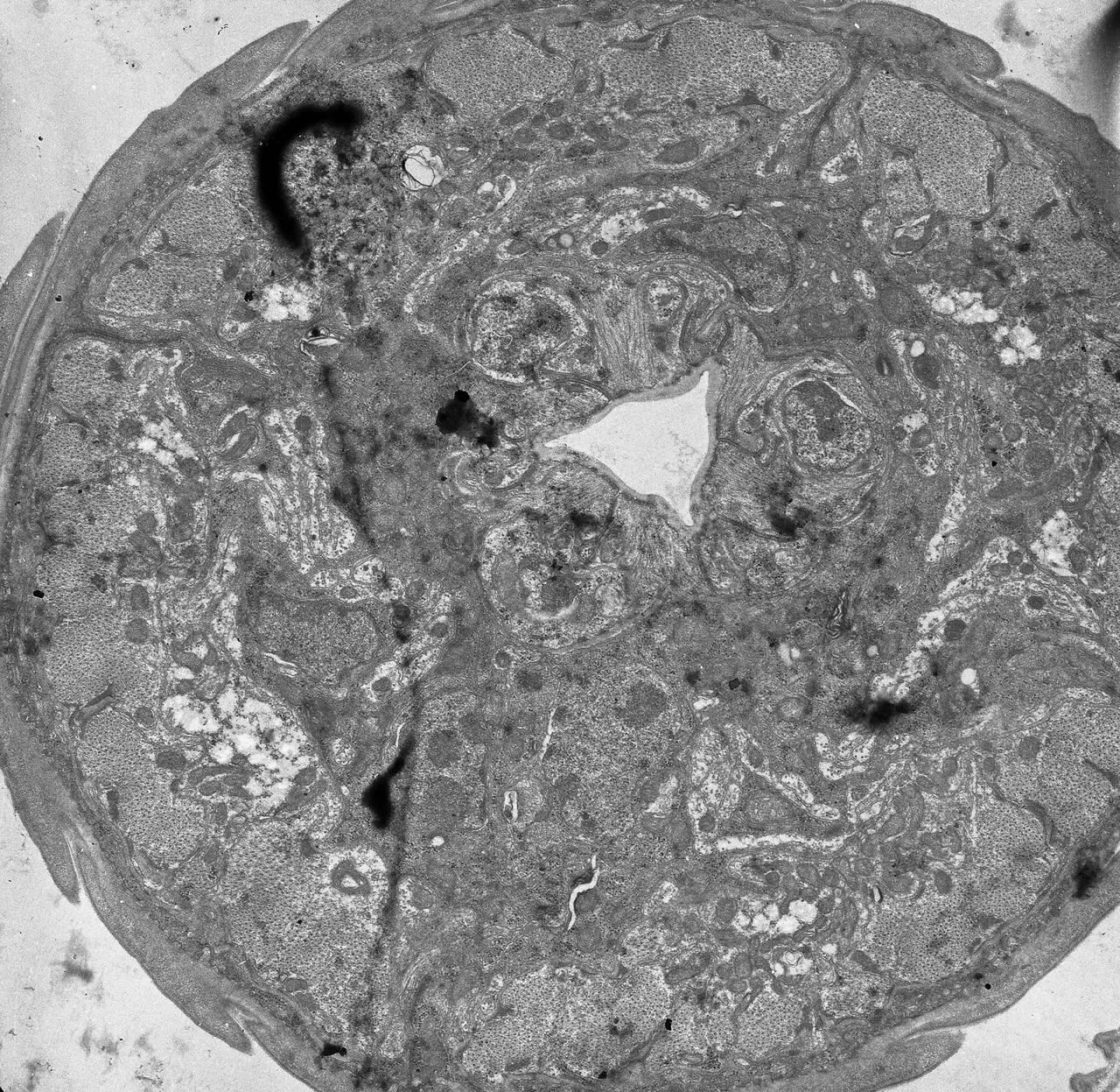 L1 esophagus at the level of nerve ring. TEM