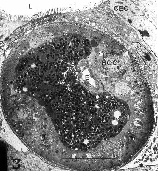Adult Female in situ in SI. TEM. E, esophagous; HGC, hypodermal gland cell; L, lumen; CEC, columnar epithelial cell. Courtesy K. Wright