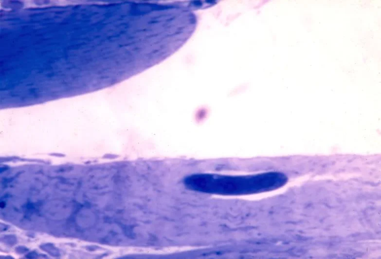 L1 inside developing nurse cell. da post-injection. Note vacuole around worm. Thick epon section.