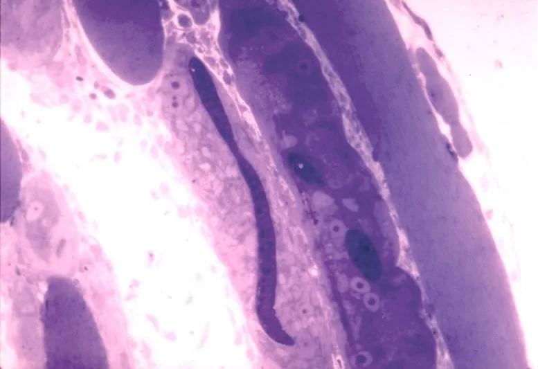 L1 in developing nurse cell. 8 da post-injection. Note worm has yet to coil up. Thick epon section.