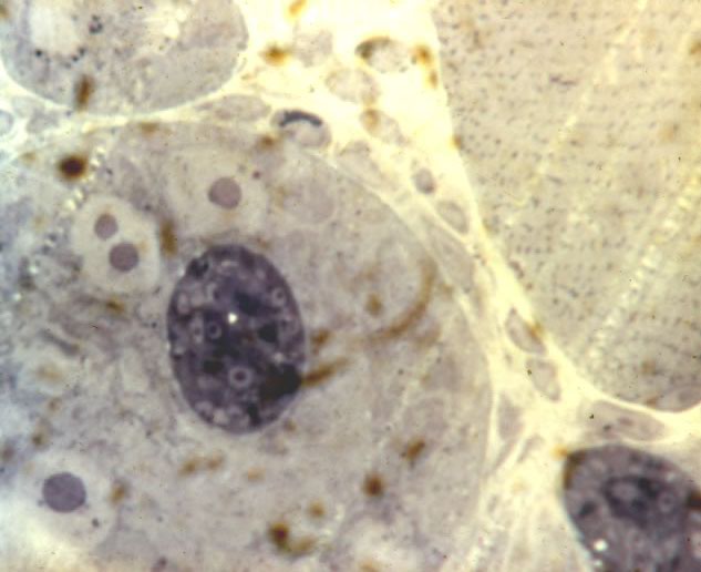 L1 in developing nurse cell. 10 da post-injection. Thick epon section.