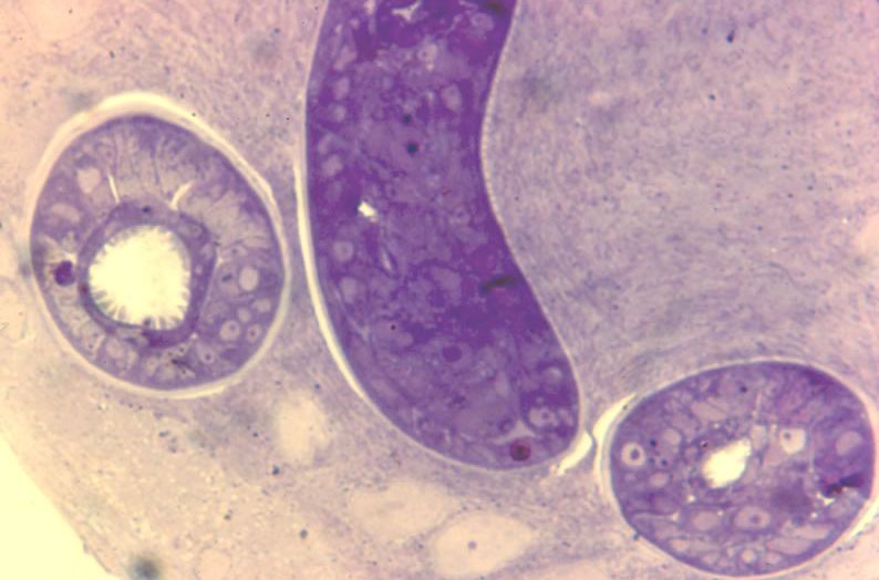 L1 in developing nurse cell. 15 da post-injection. Parasite now infectious for a new host. Thick epon section.