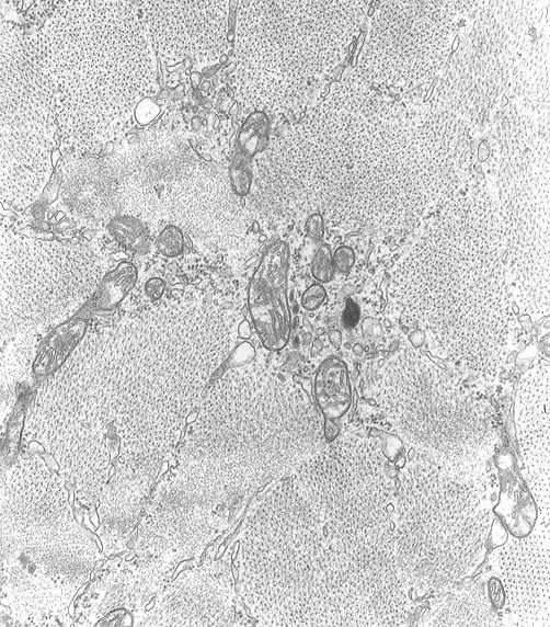 Muscle cell several days after injection of newborn larvae. Note vaculolated host cell mitochondria. TEM