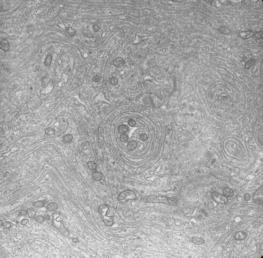 Mature nurse cell cytoplasm 20 days after injection of newborn larvae. Note lack of contractile elements and presence of whorls of smooth membrane. TEM