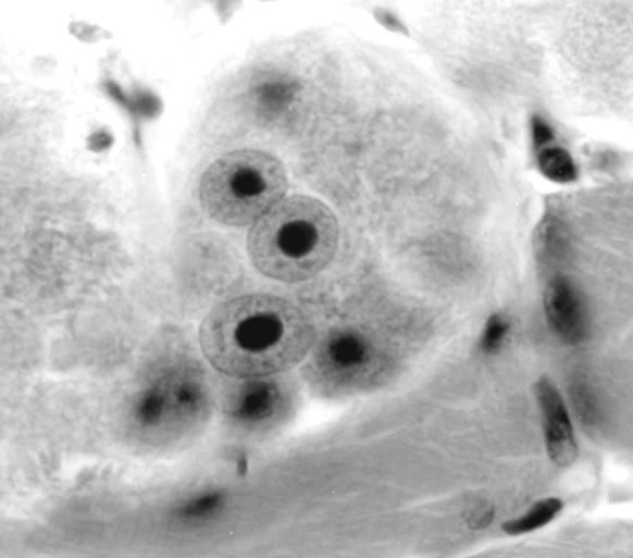 Enlarged nurse cell nuclei 12 days after injection of newborn larvae. H&E