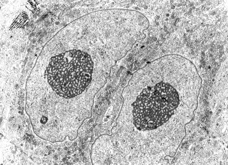 Mature nurse cell nuclei 20 days after injection of newborn larvae. Note reticular appearance of nucleoli. N=4 TEM