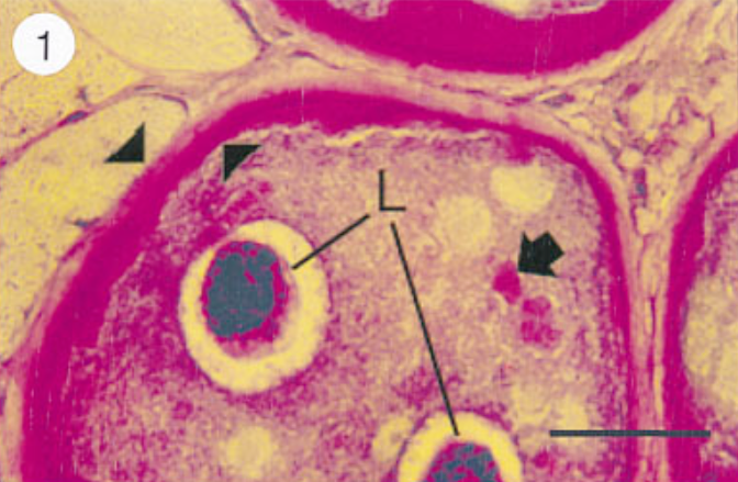 Mature nurse cell-parasite complex stained with PAS to detect collagen. Note that worm cuticle also contains collagen. Paraffin section. 