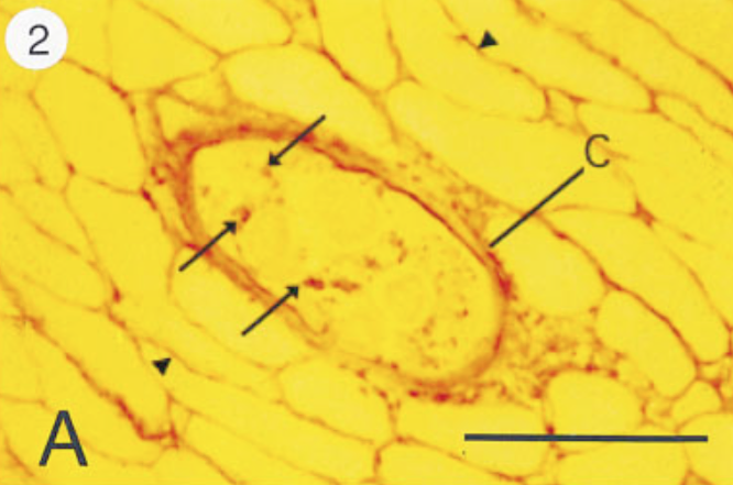 Mature nurse cell-parasite complex stained with antibodies to type IV collagen. Note only the capsule of the nurse cell stains positive. Paraffin section.