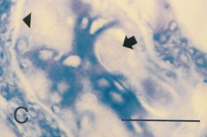 In situ hybridization of sections from mouse tissue 15 days after injection, using a probe for type IV collagen. 