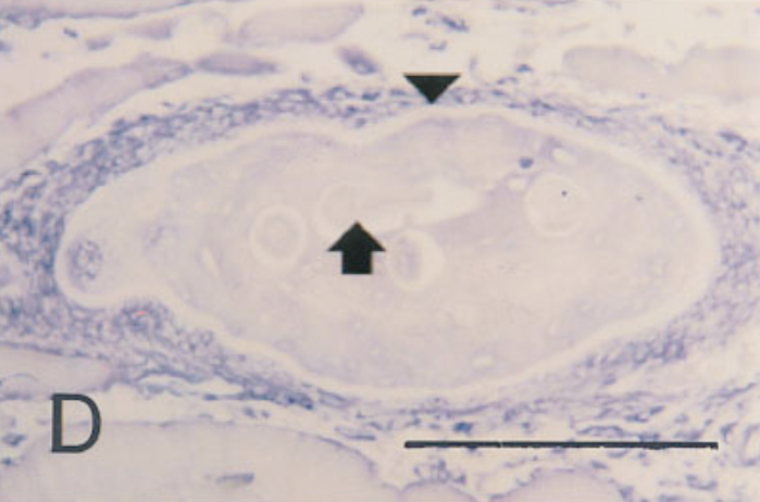 In situ hybridization of sections from mouse tissue 8 months after injection, using a probe for type IV collagen. Note lack of signal.