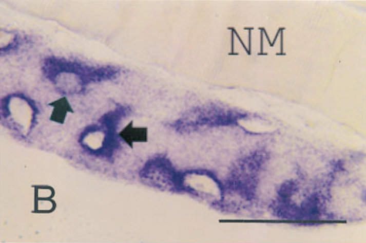 In situ hybridization of sections from mouse tissue 9 days after injection, using a probe for type VI collagen.