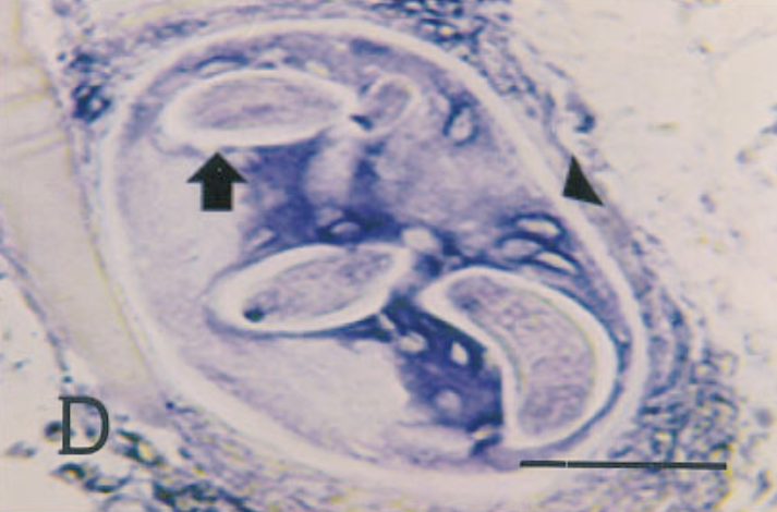 In situ hybridization of sections from mouse tissue 24 days after injection, using a probe for type VI collagen. 