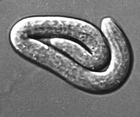 Newborn larva, high magnification. Phase interference Nomarski optics.