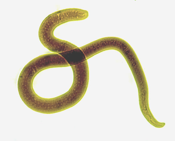 L3 female