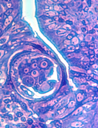Adult female in situ, cross section. Epon embedded thick section. Worm is embedded in a single row of columnar epithelial cells.