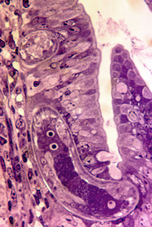 Adult female in situ, longitudinal section. Epon embedded thick section. Worm is embedded in a single row of columnar epithelial cells.