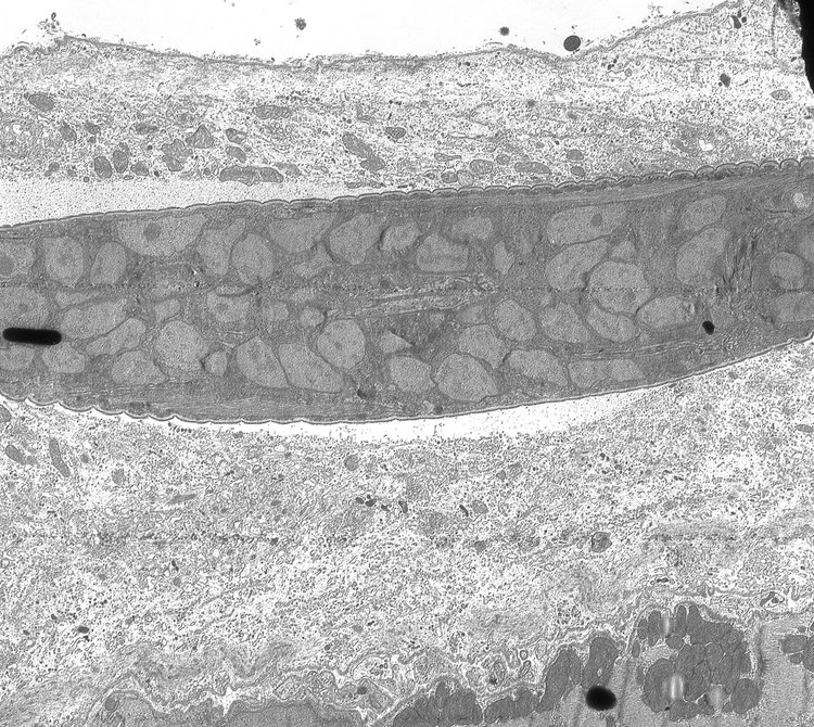 L1 inside developing nurse cell. 4 days post-injection. Note lack of integration of host cell cytoplasm with larval cuticular surface. TEM