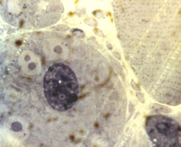L1 in developing nurse cell. 10 days post-injection. Thick epon section.