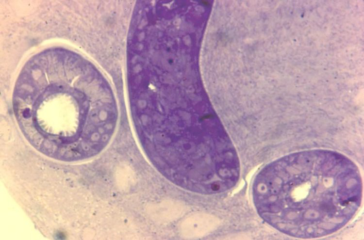 L1 in developing nurse cell. 15 days post-injection. Parasite now infectious for a new host. Thick epon section.
