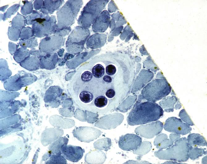 Mature nurse cell-parasite complex. Thick epon section.