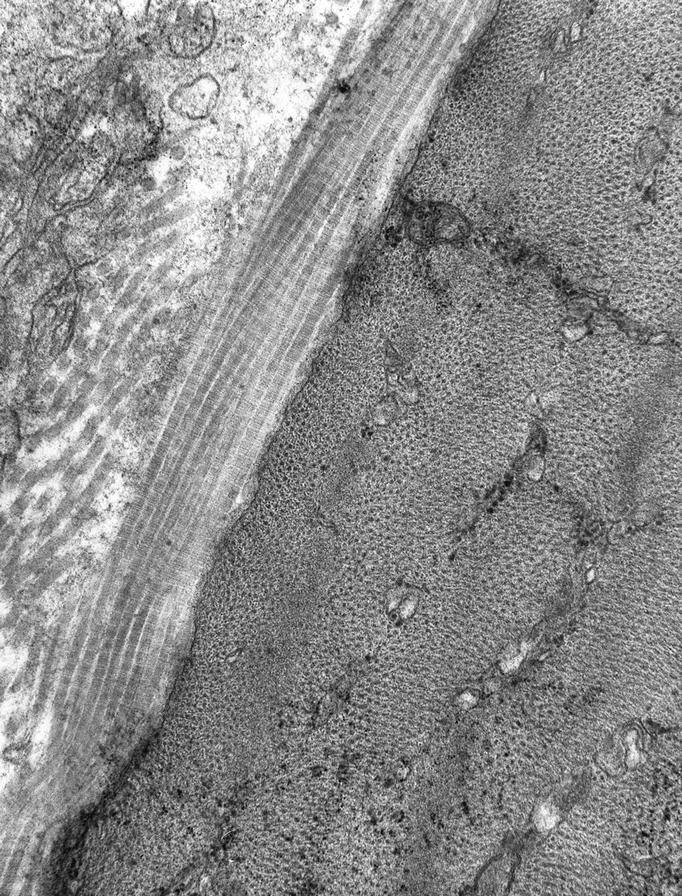 Normal striated skeletal muscle. Note contractile elements abut the sarcolemmal membrane. TEM