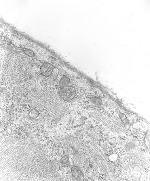 Muscle cell several days after injection of newborn larvae. Note disruption of cytoplasm near sarcolemmal membrane. TEM
