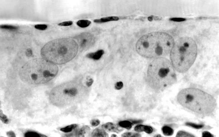 Enlarged nurse cell nuclei 12 days after injection of newborn larvae. H&E