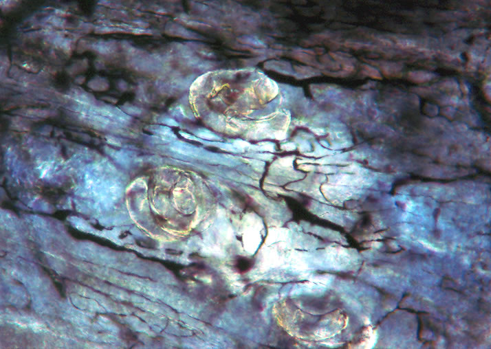 Circulatory rete surrounding a mature nurse cell of an infected mouse. Note larvae in nurse cells. India ink preparation.