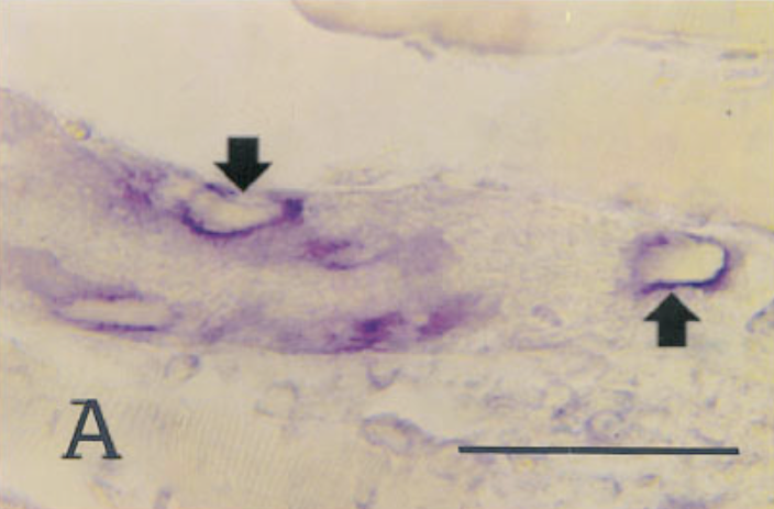 In situ hybridization of sections from mouse tissue 7 days after infection, using a probe for type IV collagen.