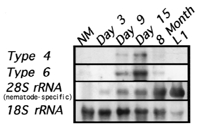Northern analysis of types 4 and 6 collagen RNAs in synchronized infected mouse muscle.