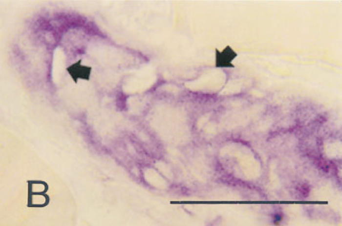 In situ hybridization with type IV RNA probe. Day 9 post-im infection.