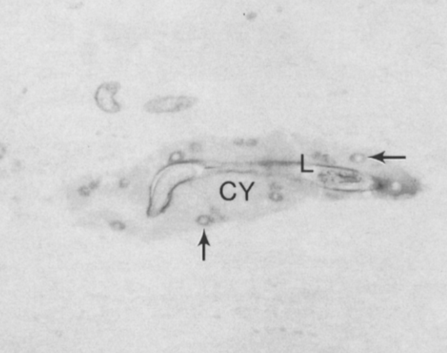 Day 9 post-im infection. Stained with anti-tyvelose antibody. Note a light staining of the entire cytoplasm of developing nurse cell, and intense staining of nucleopplasm of each enlarged host cell nucleus.