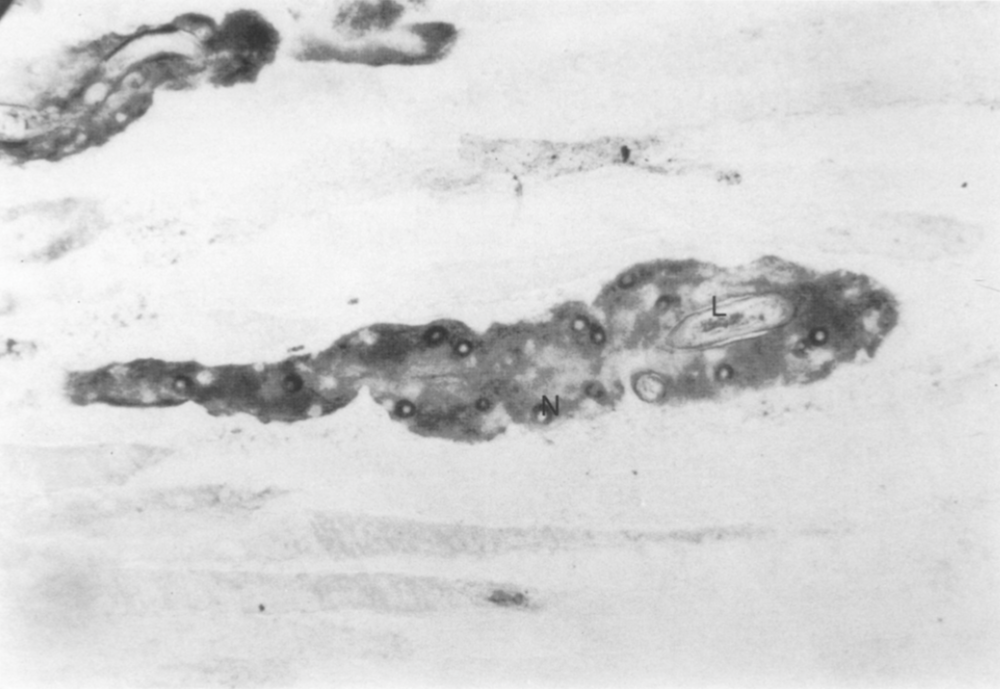Day 18 post-im infection. Stained with anti-tyvelose antibody. Note intense staining of cytoplasm and nucleoplasm of the now fully developed nurse cell.