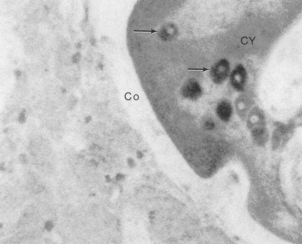 180 days post-im infection. Stained with anti-tyvelose antibody. Note pattern of staining is the same as on day 18.