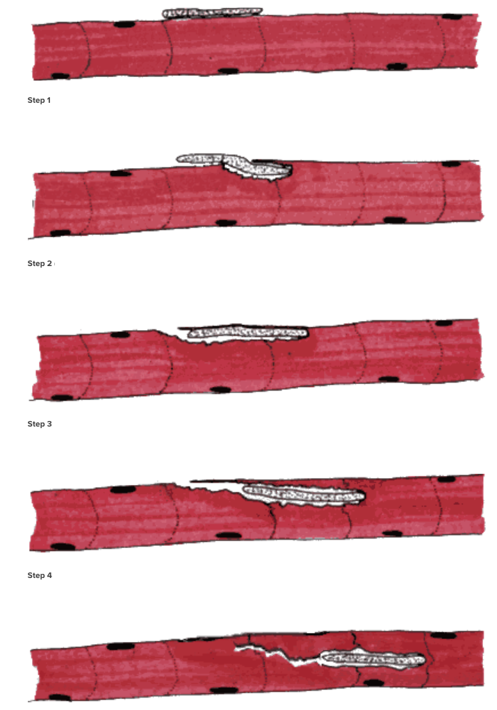 Schematic of Larva Invading a Muscle Cell