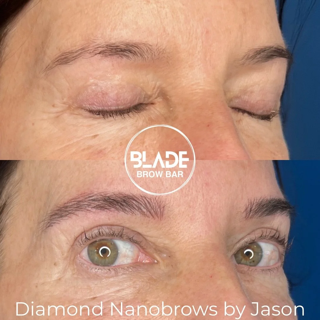 A subtle lift - it&rsquo;s all in the arch.

Artist: Jason
Technique: machine hairstrokes (Diamond Nanobrows - exclusive to BLADE)
Duration: 1 hour
Results: 1-3 years
Location: Sydney and Auckland

#nanobrows #machinehairstrokes #browgoals #pmu #sydn