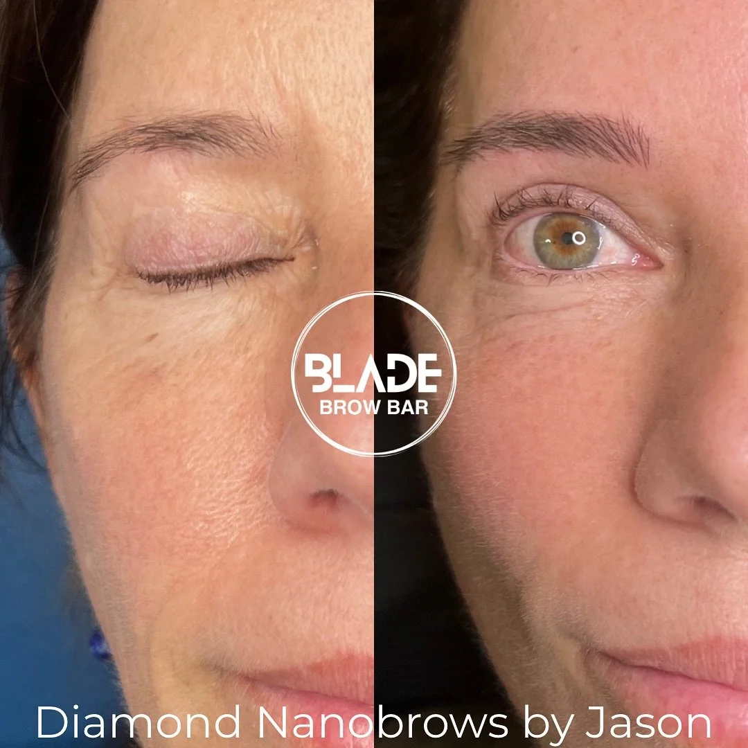 A subtle lift, it&rsquo;s all in the arch!

Artist: Jason
Technique: machine hairstrokes (Diamond Nanobrows - exclusive to BLADE)
Duration: 1 hour
Results: 1-3 years
Location: Sydney and Auckland

#nanobrows #machinehairstrokes #browgoals #pmu #sydne