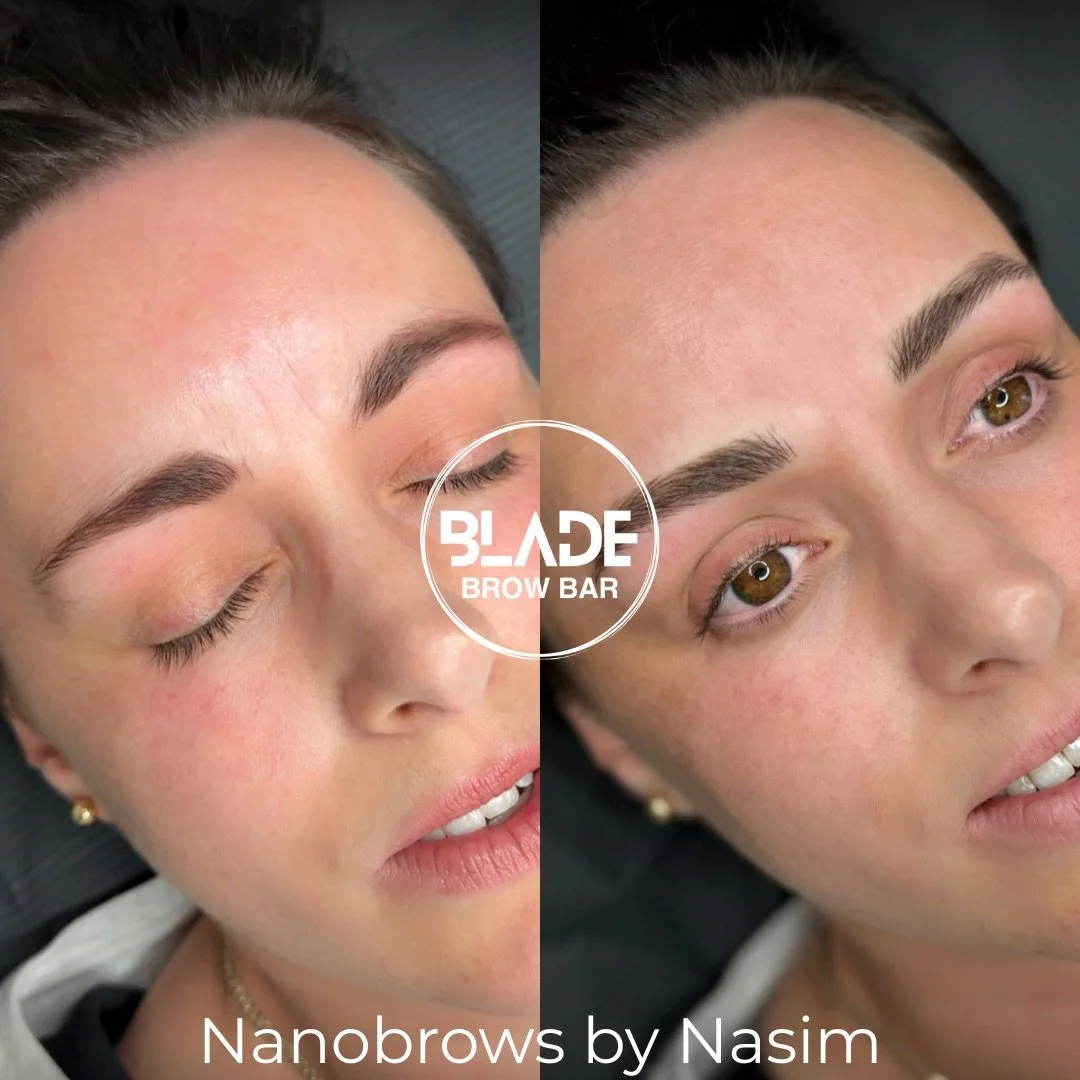 Stunning transformation by Nasim!

Artist: Nasim
Technique: machine hairstrokes (Nanobrows)
Duration: 2.5 hours
Results: 1-3 years
Location: Auckland