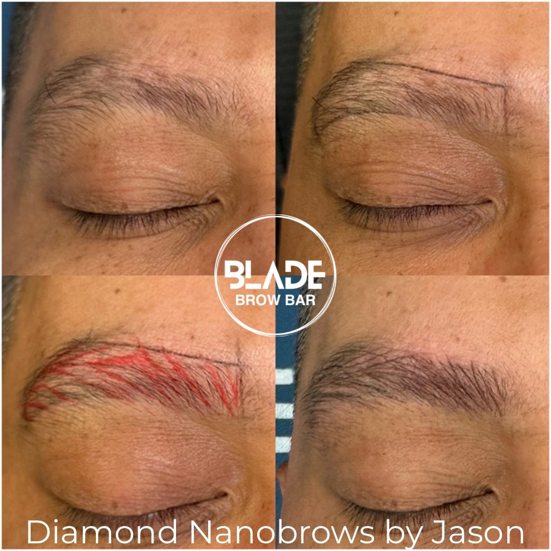 Men&rsquo;s nanobrows! Filling in sparse areas to provide a more even density.

Artist: Jason
Technique: machine hairstrokes (Diamond Nanobrows - exclusive to BLADE)
Duration: 1 hour
Results: 1-3 years
Location: Sydney and Auckland

#nanobrows #machi