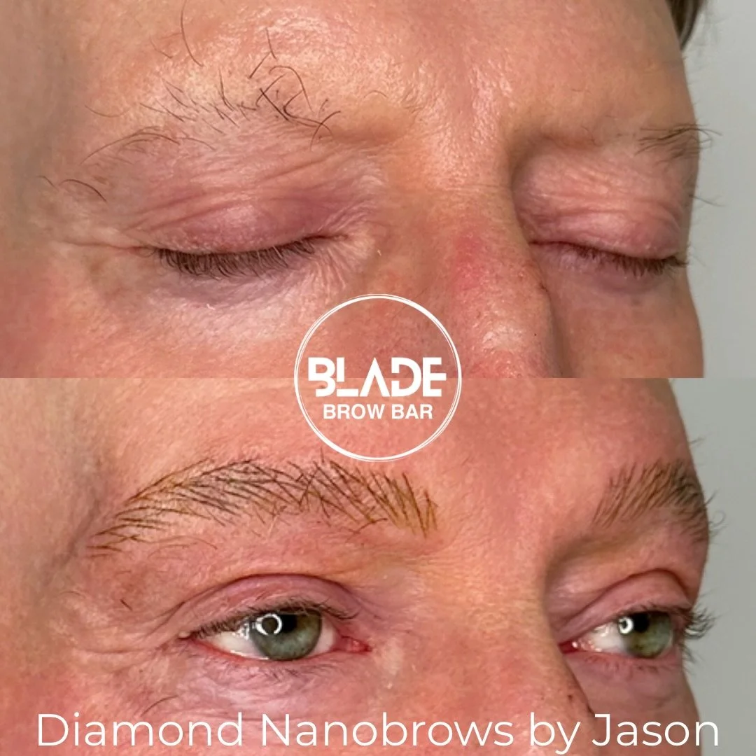 Alopecia brows 💥💪

Artist: Jason
Technique: machine hairstrokes (Diamond Nanobrows - exclusive to BLADE)
Duration: 1 hour
Results: 1-3 years
Location: Sydney and Auckland

#nanobrows #machinehairstrokes #microblading