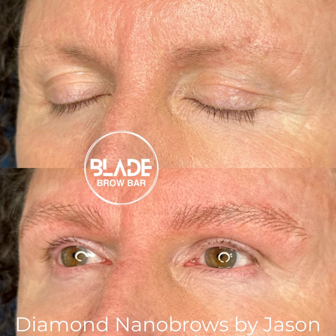 Men&rsquo;s Nanobrows 🤌🏽

Artist: Jason
Technique: machine hairstrokes (Diamond Nanobrows - exclusive to Jason at BLADE)
Duration: 1 hour
Results: 1-3 years
Location: Sydney and Auckland

#nanobrows #machinehairstrokes #microblading &hellip;not Mic