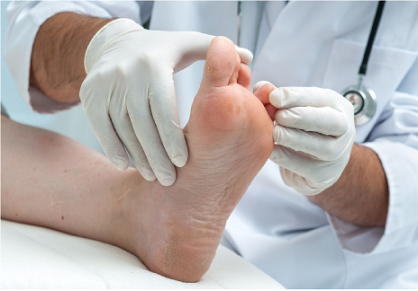 29766672_L_Scleroderma_Toes_Doctor_Feet_Examine.png