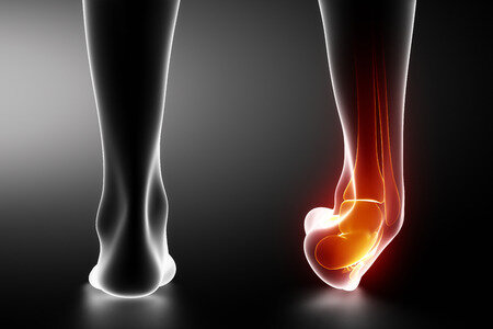32385705_S_ankle_injury.jpg