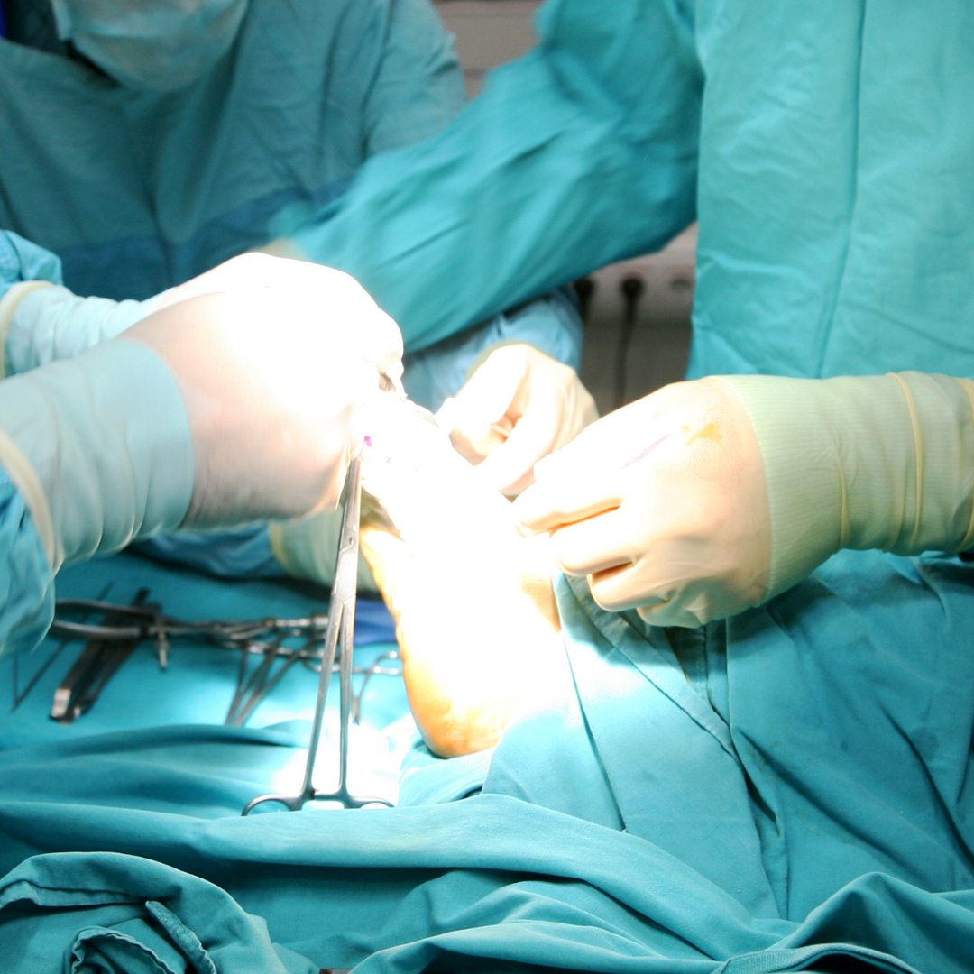 Planning for Successful Podiatric Surgery